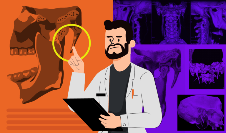 Síndrome de Eagle: imagem ilustrada de um dentista olhando um exame de imagem de um paciente para identificar a causa da dor orofacial.